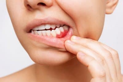 periodontal gum disease in women 63f3d5c2e3303